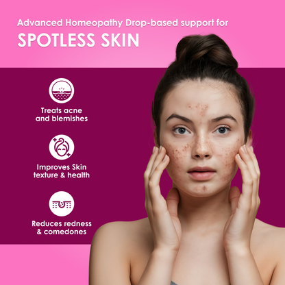 Acnedonna Advanced Homeopathy 2.0 for Acne, Pimples & Skin Clarity Support | Oral Drops | 30ml