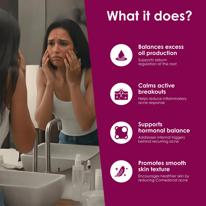 Acnedonna - For Healthy Skin - Meethi Golee