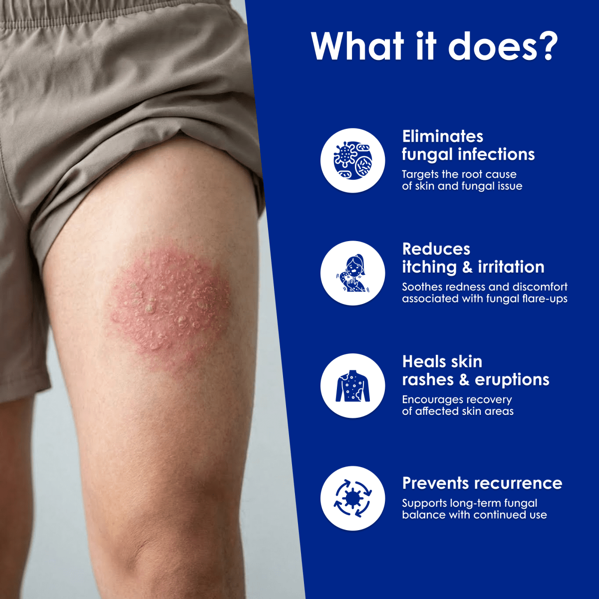 Fungal Clear - Meethi Golee