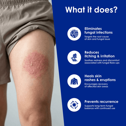 Fungal Clear - Meethi Golee